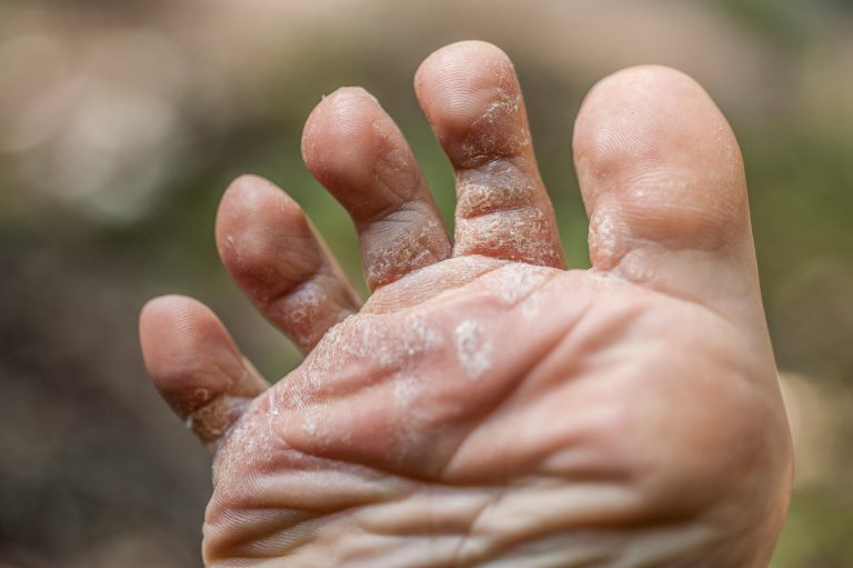 Resistente schimmels wereldwijd te lijf met vijfstappenplan
