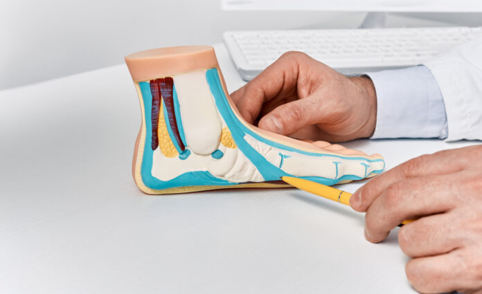 Anatomical flat foot model on doctor table while consultation in orthopedics center. Treatments for flat feet and pes planus Anatomical flat foot model on doctor table while consultation in orthopedics center. Treatments for flat feet and pes planus
